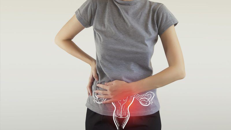 rakovina krčka maternice